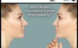 Will Health Insurance Cover Rhinoplasty?
